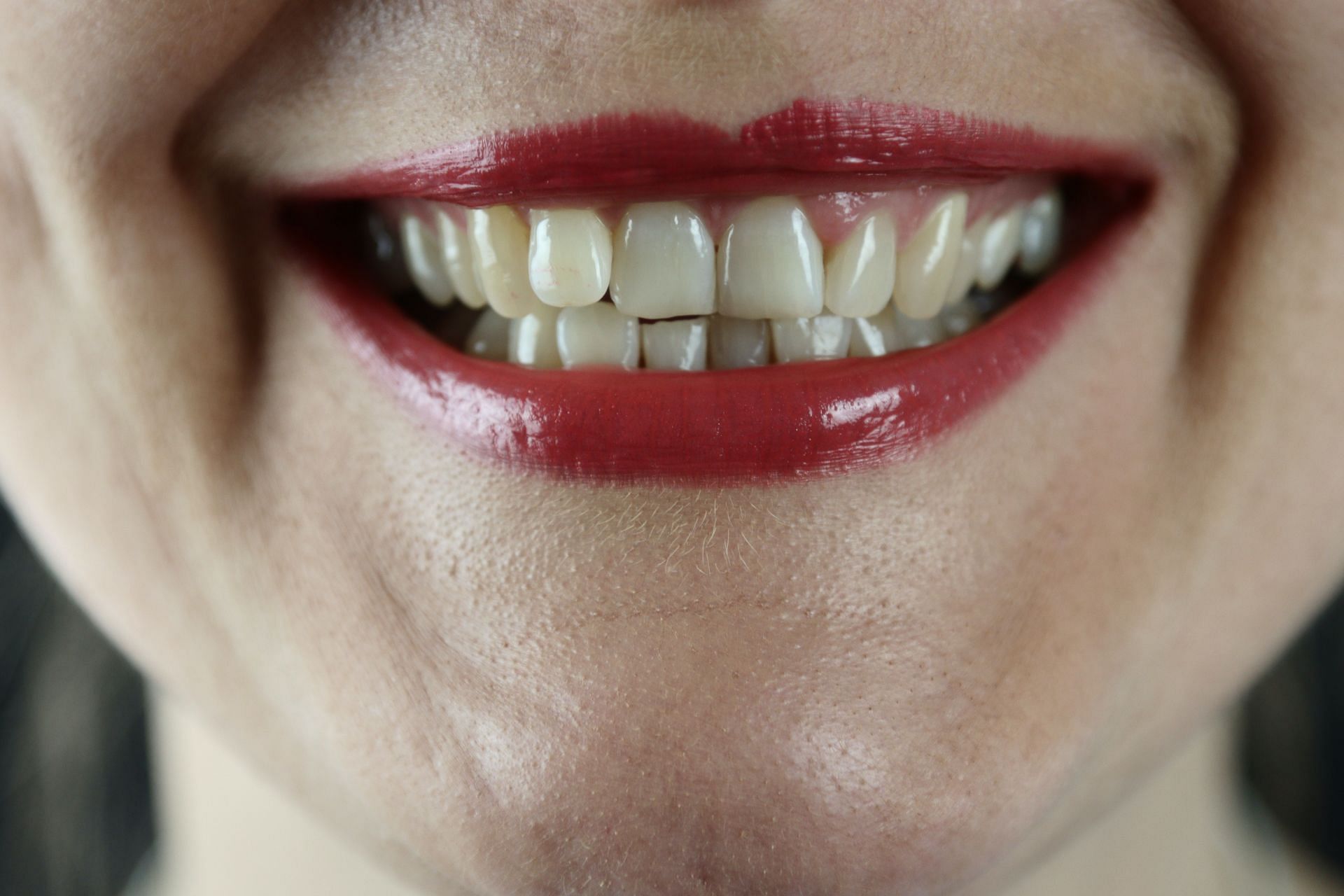 CTS can be caused due to chewing hard object. (Image via Unsplash/ Marek Studzinski)